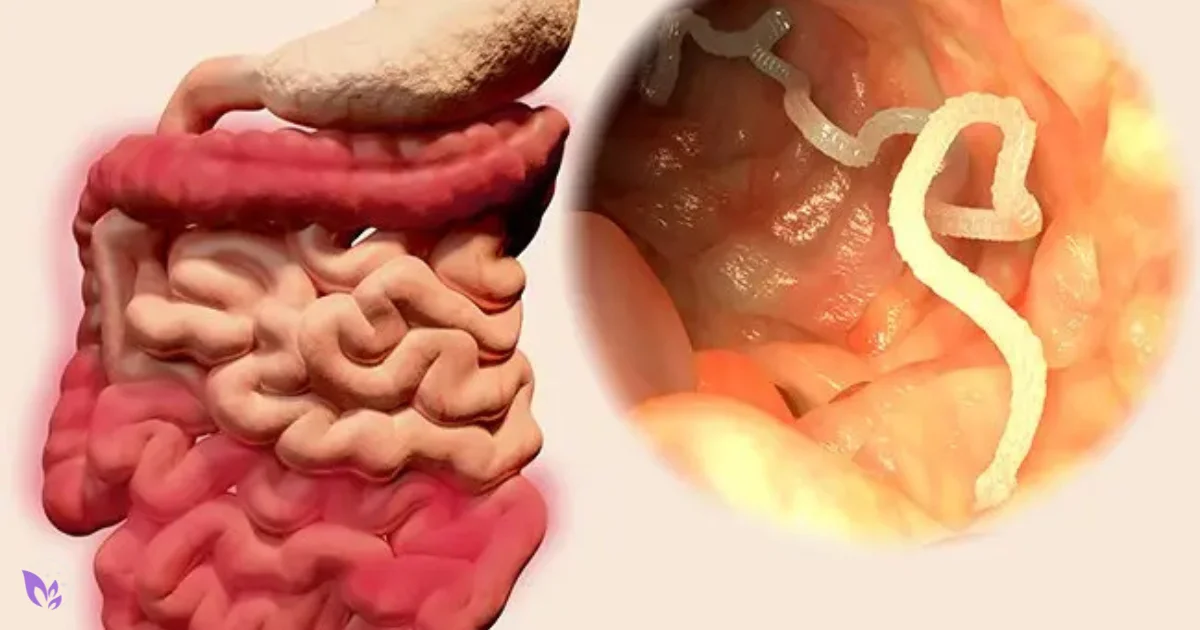 Parasite Cleanses: What to Know About Gut Health, Side Effects, Diet, and Safety