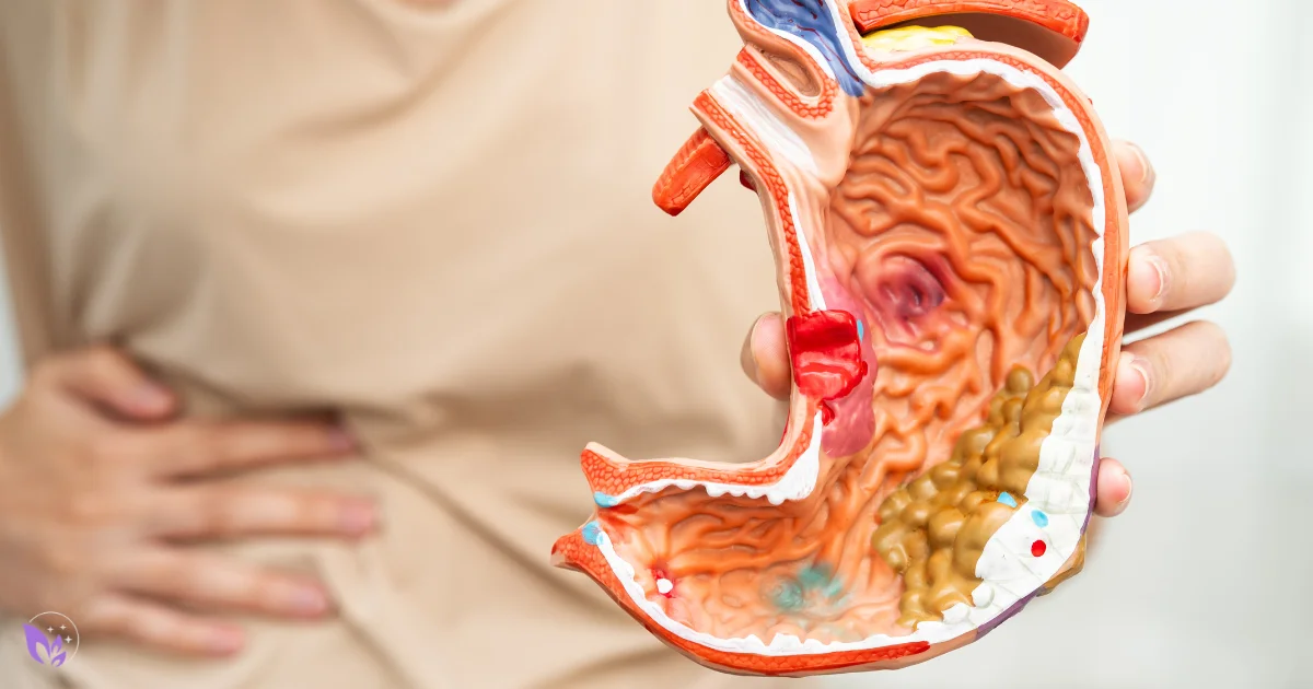 Can Parasites Cause Weight Gain? Symptoms, Bloating, and Medical Evidence